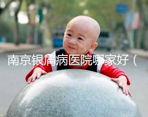 南京銀屑病醫(yī)院哪家好(南京專(zhuān)門(mén)看銀屑病醫(yī)院)