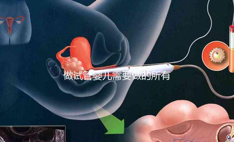 做試管嬰兒需要做的所有檢查（做試管嬰兒需要做的所有檢查項(xiàng)目）