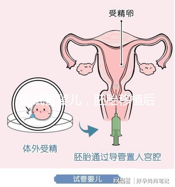 做試管嬰兒,胚胎移植后需要住院嗎?
