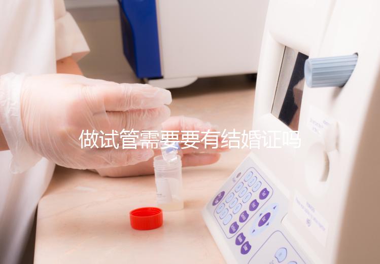 做試管需要要有結婚證嗎?
