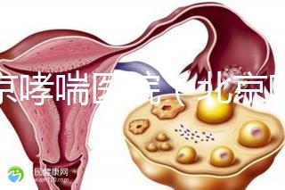 北京哮喘醫院(北京哮喘醫院哪家好)