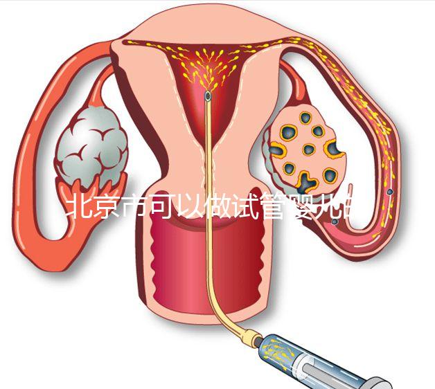 北京市可以做試管嬰兒的公立醫(yī)院有哪些