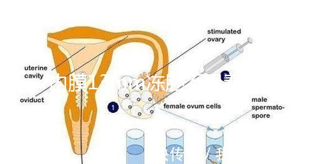 內(nèi)膜13mm凍胚不易著床要注意，移植與否看醫(yī)生怎么說