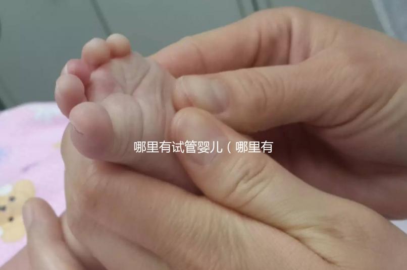 哪里有試管嬰兒(哪里有試管嬰兒的醫院)