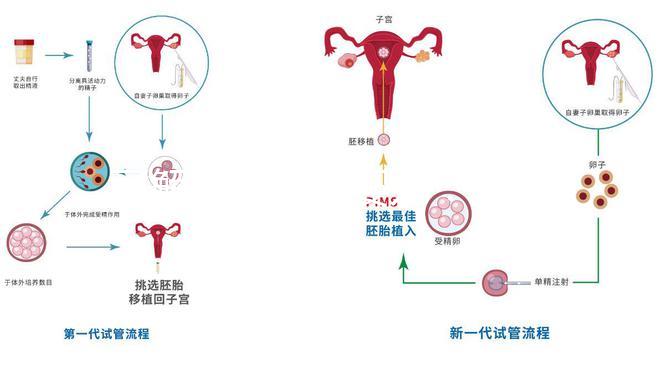 了解二代試管嬰兒：技術(shù)原理與優(yōu)勢(shì)解析