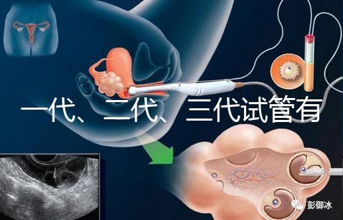 一代、二代、三代試管有什么區(qū)別？