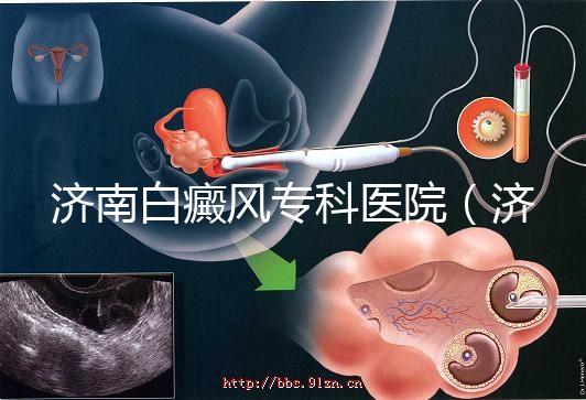 濟(jì)南白癜風(fēng)專科醫(yī)院(濟(jì)南白點(diǎn)癲風(fēng)醫(yī)院排名)