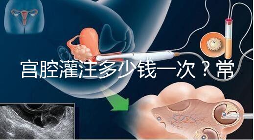 宮腔灌注多少錢一次?常見疑問匯總答疑