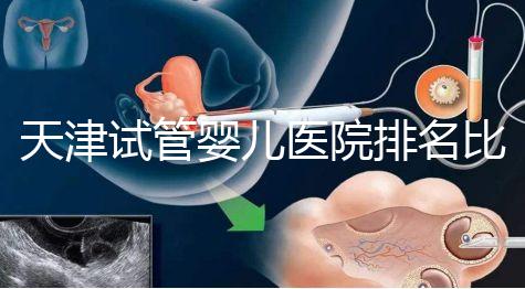 天津試管嬰兒醫院排名比較好