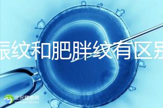 妊娠紋和肥胖紋有區(qū)別,教你3種“花紋”診斷鑒別的方法