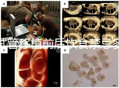 試管移植前后飲食禁忌多,十大不利于胚胎著床的水果別亂吃