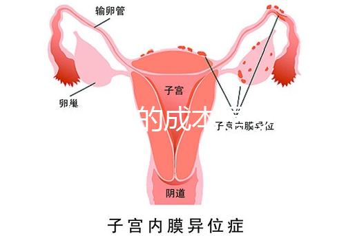 試管嬰兒的成本是多少?需要多少錢(qián)?