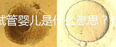 試管嬰兒是什么意思？什么是試管嬰兒？