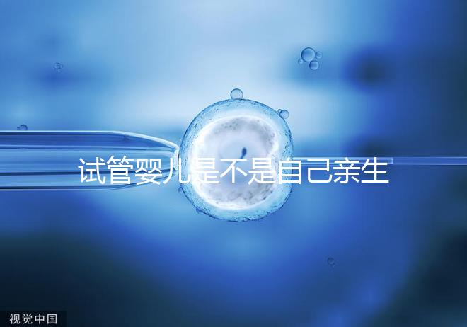 試管嬰兒是不是自己親生的(做試管嬰兒是不是自己的孩子)