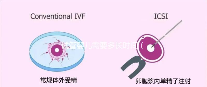 試管嬰兒需要多長(zhǎng)時(shí)間(試管嬰兒需要多長(zhǎng)時(shí)間完成)