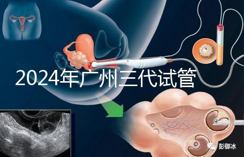 2024年廣州三代試管嬰兒費(fèi)用明細(xì)公布!
