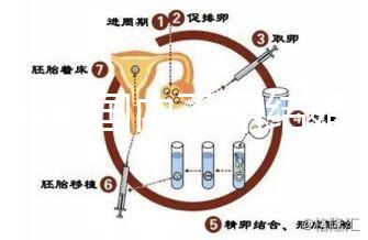 2024年國(guó)內(nèi)不用結(jié)婚證做試管嬰兒的醫(yī)院排名一覽