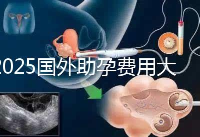 2025國外助孕費用大公開:單身人士費用對比與機構(gòu)推薦